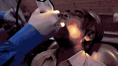 Digital intraoral scanning in action at V Smile Dental Clinic